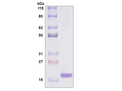 Recombinant Human Galectin 7, His Tag -50 ug